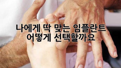 나에게 딱 맞는 임플란트, 어떻게 선택할까요?